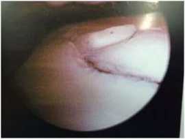 Ankle Pain Treatment Singapore Expert Care , Bukit Timah