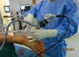 Precision Foot Fracture Surgery Trusting in Skille, Bukit Timah