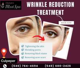 Wrinkle Treatment in Warrenton |Lifestyle’s MedSpa, Warrenton