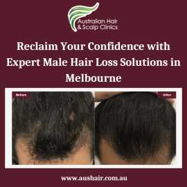 Regain Your Confidence with Aushair's Male Hair Lo