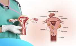 Discover the Myomectomy Cost in Whitefield, Manipa, Bengaluru