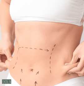 Abdominoplasty in Dubai | Achieve a Tighter Tummy , Dubai