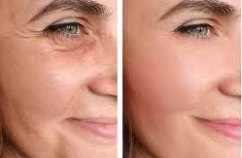 Effective Dark Spot Removal Solutions, Jacksonville