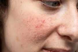 Effective Wrinkle Reduction Treatment, Jacksonville
