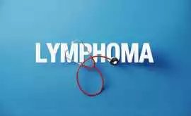 Lymphoma Cancer with Lymphoma Canada, Mississauga
