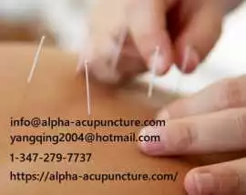 Best cupping therapy treatment in New York, New York
