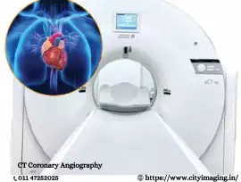 CT Coronary Angiography Price Know the Cost Clearl, Delhi