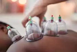 Best Cupping Therapy Services for Pain Relief Toda, London