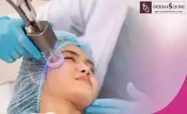 Best CO2 Laser Treatment in Bangalore , Bengaluru