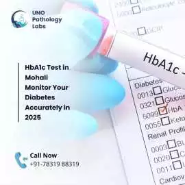 HbA1c Test in Mohali – Monitor Your Diabetes, Mohali