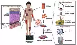 Rare Skin Diseases, New York