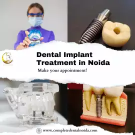 Smile Makeover with Best Dental Implants in Noida, Noida