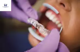 Invisalign Clear Braces in Valdese – Western Piedm, Alabama