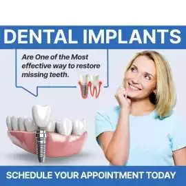 Get Your Smile Back with Affordable Dental Implant, Chandigarh