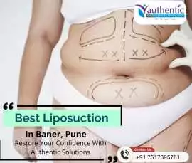 Seeking for the best liposuction in Pune? , Pune