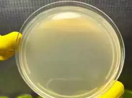 Grow with Precision: Pre-Poured Agar Petri Dishes , Elizabeth