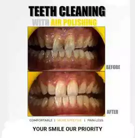 Top Rated Family Dentist Near You, Chandigarh