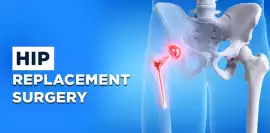 Get the Best Hip Replacement Surgery Hospital in N, Noida