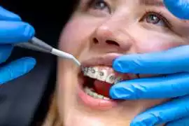 Top-Rated Orthodontist Lorton VA, Woodbridge