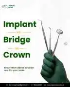 Trusted Dental Treatment in Noida for Every Dental, Noida