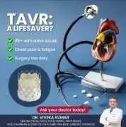 Top TAVI Experts in India for Personalized Heart V, Saket