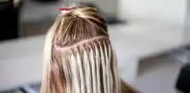 Discover Expert Hair Loss Solutions in Dallas.., Carrollton