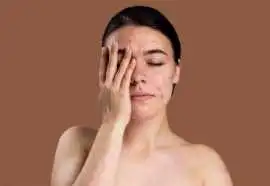 Acne Treatment in Greater Noida, Noida