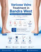 Effective Treatment for Healthy Legs, Mumbai