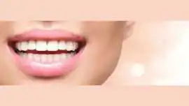 Top Veneers in Hillsborough Dental CosmeticConcept, Hillsborough