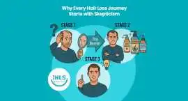 Turn Hair Loss Skepticism into Confidence, Subiaco