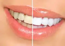 Trusted Dentist in Noranda – Quality Dental Care f, Malaga