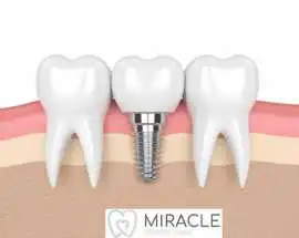 Dentist Croydon Park – Quality Dental Care , Sydney