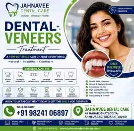 Dental Veneers Treatment in Ahmadabad , Ahmedabad