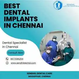 Best Dental implants in chennai | Sendhil dental, Chennai