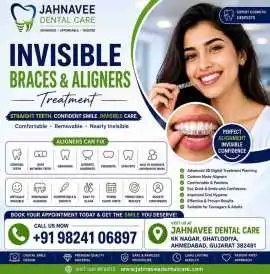 Invisible Braces & Aligners Treatment, Ahmedabad