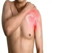 Shoulder Pain | Rotator Cuff Repair Specialist, New York