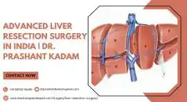 Advanced Liver Resection Surgery in India, Mumbai