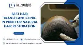 Best Hair Transplant Clinic in Pune , Pune