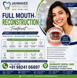 Full Mouth Reconstruction Treatment in Ahmadabad, Ahmedabad
