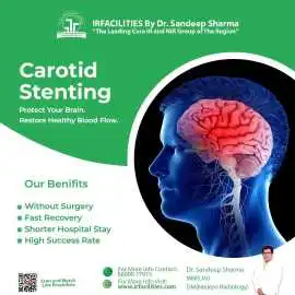 ICA Stents | Innovative Procedure for Narrowing, Chandigarh