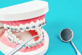 Metal Braces in San Antonio for a Straighter, Heal, San Antonio
