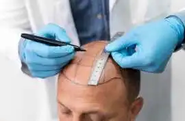 Hair Doctor Prayagraj Offering Personalized Care, Allahabad
