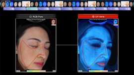 DermaQuip: A Comprehensive Guide to skin camera im, Addison