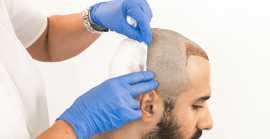Visit Harleys for the Best Hair Transplant Surgery, Mumbai