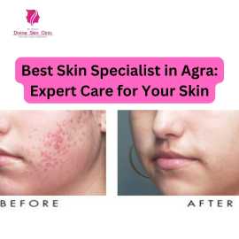 Best Skin Specialist in Agra: Expert Care for Your, Agra