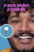 Dental Implants in Coimbatore, Coimbatore