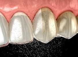 Cosmetic Dental Care | Plumstead | Denvolve, London