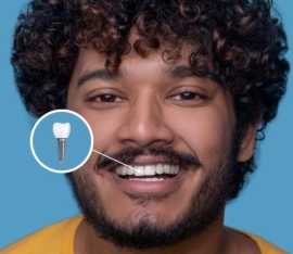 Implant Dentist in Ahmedabad: Expertise in Smile T, Ahmedabad
