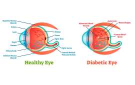 Best Diabetes Specialist in Jaipur, Jaipur