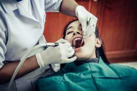 Wisdom Teeth Removal in Mississauga | Mississauga , Mississauga